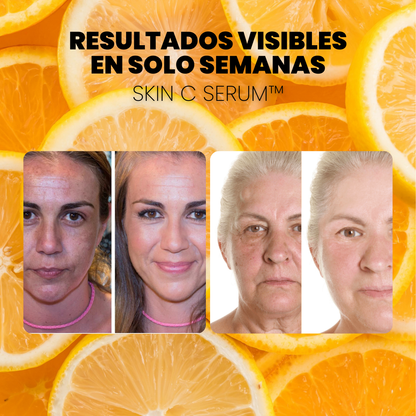 SERUM CONCENTRADO de VITAMINA C. COLÁGENO y ÁCIDO HIALURÓNICO - SKIN C SERUM™ (1 + 2 GRATIS)