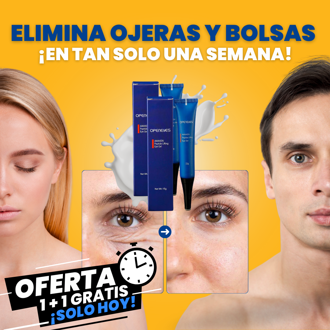 CREMA PARA OJERAS Y BOLSAS | 100% de efectividad | OpenEyes™ (1 + 1 GRATIS)