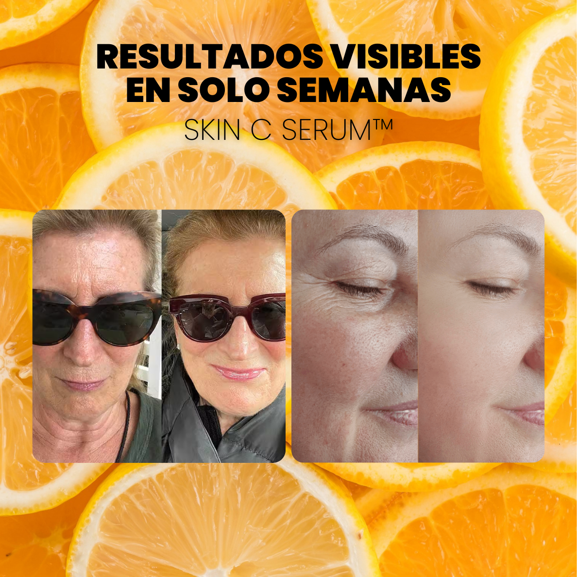 SERUM CONCENTRADO de VITAMINA C. COLÁGENO y ÁCIDO HIALURÓNICO - SKIN C SERUM™ (1 + 2 GRATIS)