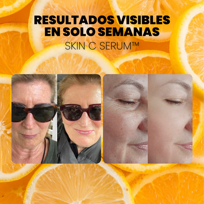 SERUM CONCENTRADO de VITAMINA C. COLÁGENO y ÁCIDO HIALURÓNICO - SKIN C SERUM™ (1 + 2 GRATIS)