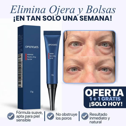 CREMA PARA OJERAS Y BOLSAS | 100% de efectividad | OpenEyes™ (1 + 1 GRATIS)