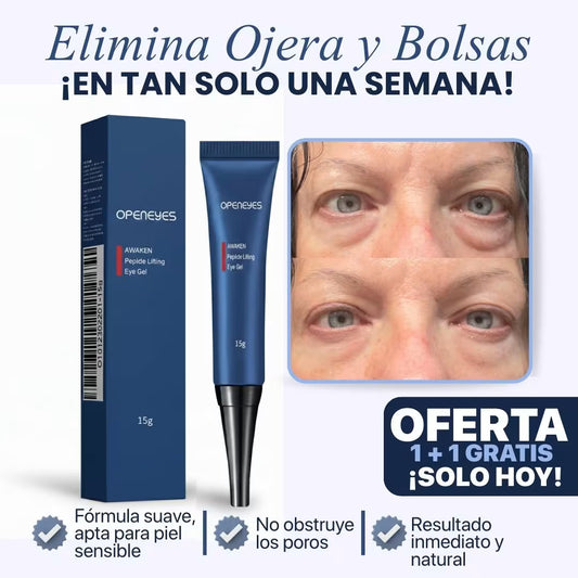 CREMA PARA OJERAS Y BOLSAS | 100% de efectividad | OpenEyes™ (1 + 1 GRATIS)