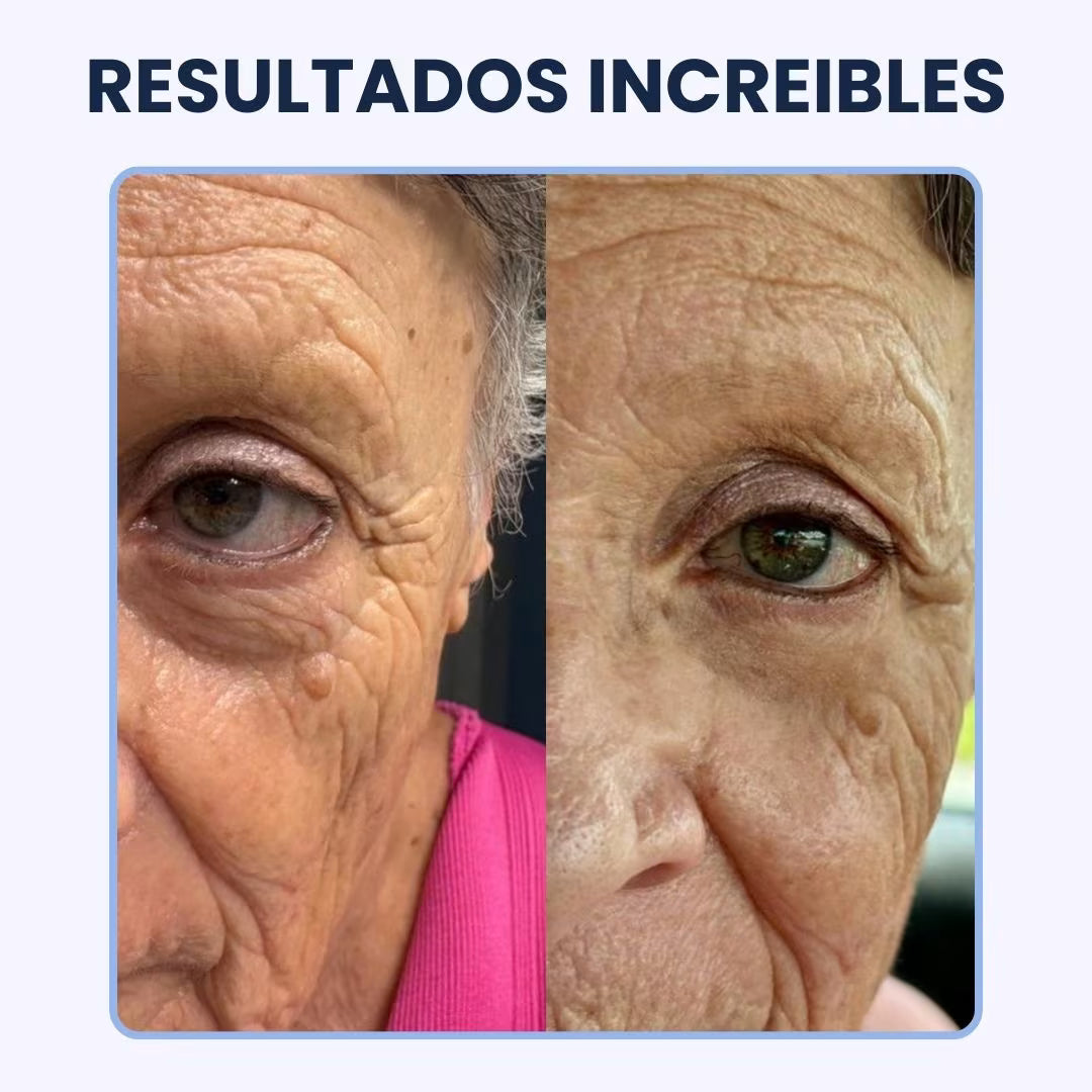 CREMA PARA OJERAS Y BOLSAS | 100% de efectividad | OpenEyes™ (1 + 1 GRATIS)