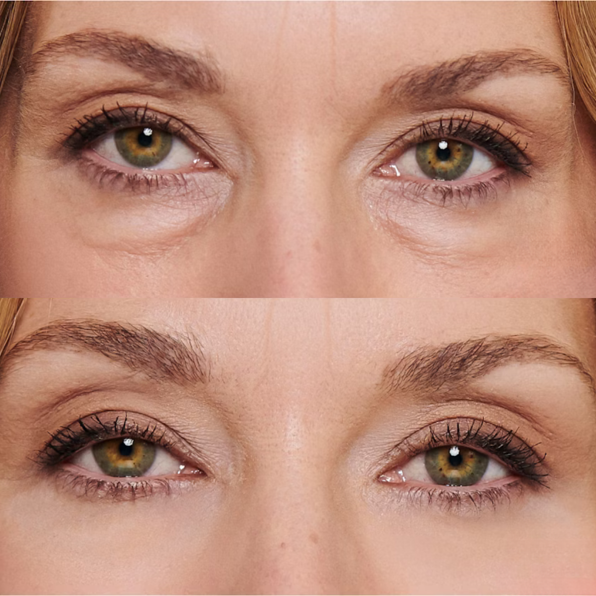 CREMA PARA OJERAS Y BOLSAS | 100% de efectividad | OpenEyes™ (1 + 1 GRATIS)