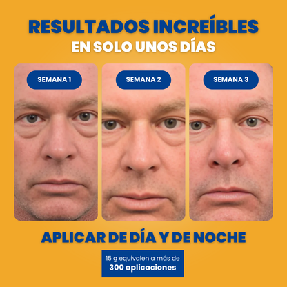 CREMA PARA OJERAS Y BOLSAS | 100% de efectividad | OpenEyes™ (1 + 1 GRATIS)