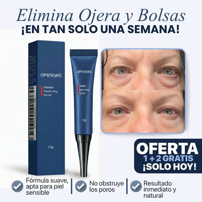 CREMA PARA OJERAS Y BOLSAS | 100% de efectividad | OpenEyes™ (1 + 2 GRATIS)